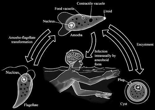 amoeba infection
